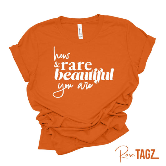 HOW RARE & BEAUTIFUL YOU ARE