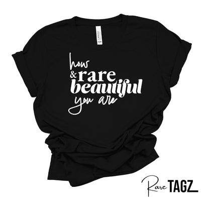 HOW RARE & BEAUTIFUL YOU ARE